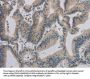 ACVR1B Antibody