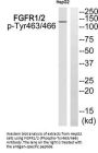Phospho-FGFR1/FGFR2 (Tyr463/466) Antibody
