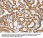 AIFM3 Antibody