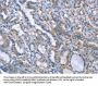 LRRK2 Antibody