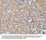 S100A9 Antibody