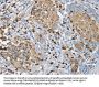 S100A9 Antibody