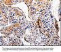 ACE2 Antibody