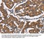 DICER1 Antibody