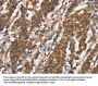 DICER1 Antibody