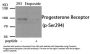 Phospho-PGR (Ser294) Antibody