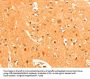 GRM3 Antibody