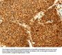 GRM3 Antibody