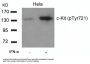 Phospho-KIT (Tyr721) Antibody