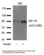 Phospho-IGF1R (Tyr1280) Antibody