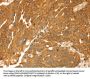 TMEFF2 Antibody