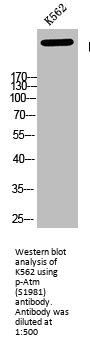 Phospho-ATM (Ser1981) Antibody