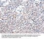 PDCD10 Antibody
