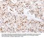 PDCD10 Antibody