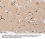 BUB1 Antibody