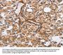 BUB1 Antibody