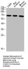 Phospho-PRKAA1/PRKAA2 (T183/172) Antibody