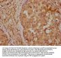 ITIH1 Antibody