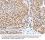 CASP7 Antibody