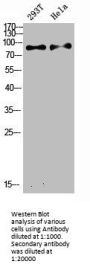 IL4R Antibody