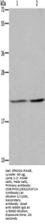 ASF1A Antibody