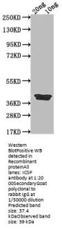 ICSP Antibody