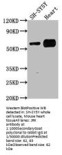 JRK Antibody