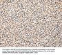 SERPINA7 Antibody