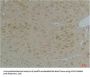 KCNIP3 Antibody