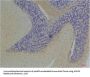 KCNIP3 Antibody