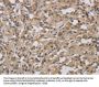 Rabbit anti-human DCN polyclonal antibody