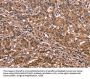 NOS2 Antibody