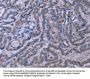 TUBGCP2 Antibody