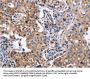 ITGB5 Antibody