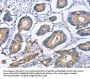 ITGB5 Antibody