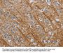 Rabbit anti-human ABL1 polyclonal antibody