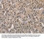 PGK1 Antibody