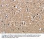 PGK1 Antibody