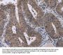 CDK5 Antibody