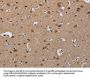 CDK5 Antibody