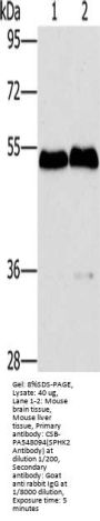 SPHK2 Antibody