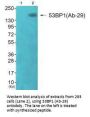 TP53BP1 (Ab-29) Antibody
