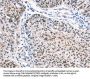 CTBP2 Antibody