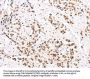 CTBP2 Antibody