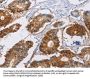 CA9 Antibody