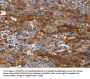 CA9 Antibody