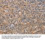 NCR2 Antibody