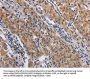 NCR2 Antibody