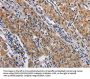 NCR2 Antibody