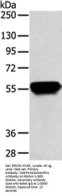 KRT4 Antibody